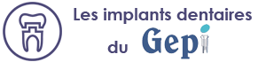 Les implants dentaires du GEPI